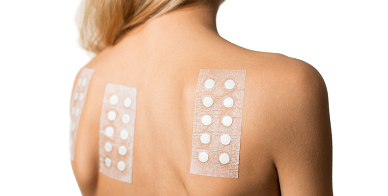 Dermal patch allergy testing in Columbia