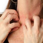 woman scratching her neck in need of allergy patch testing