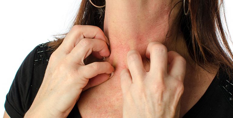 woman scratching her neck in need of allergy patch testing