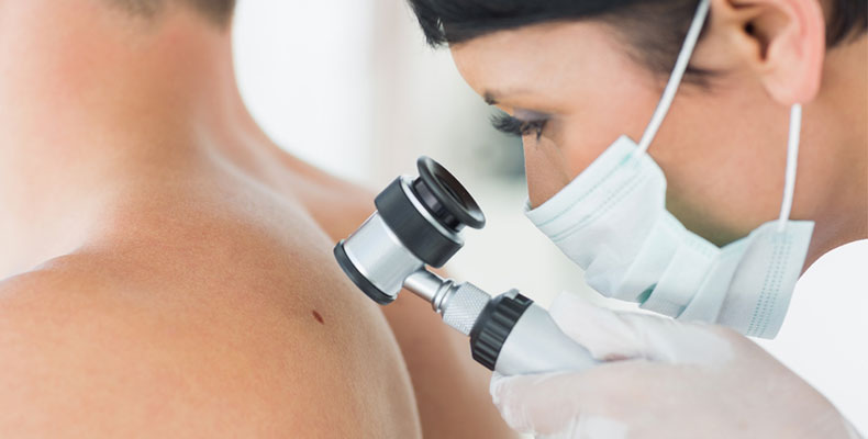 What to expect during a skin cancer screening