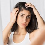 6 Causes of Dandruff and How to Treat Them