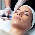 woman receiving microneedling with exosomes cosmetic dermatology treatment