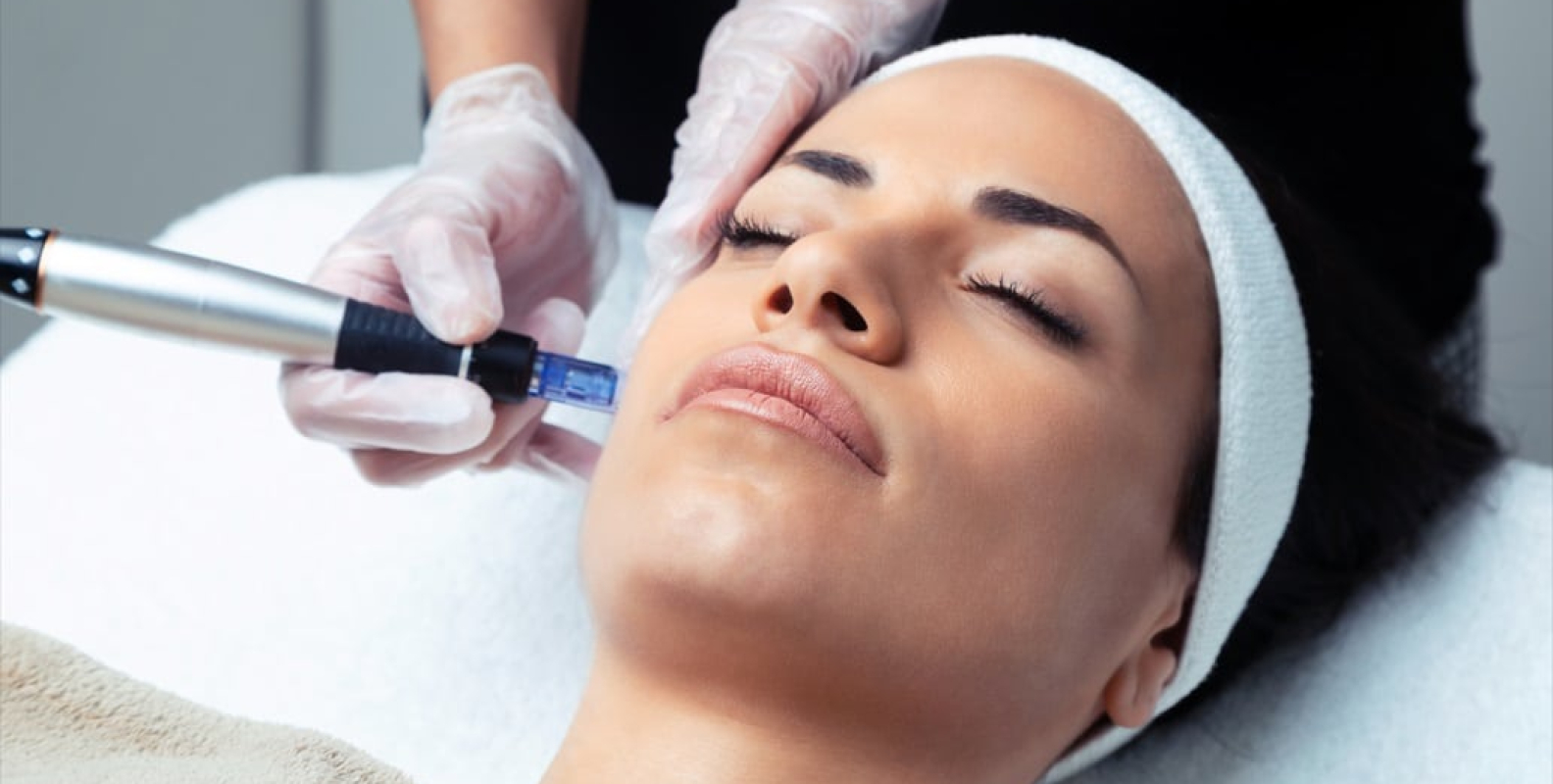 All About Microneedling With Exosomes | Columbia Skin Clinic